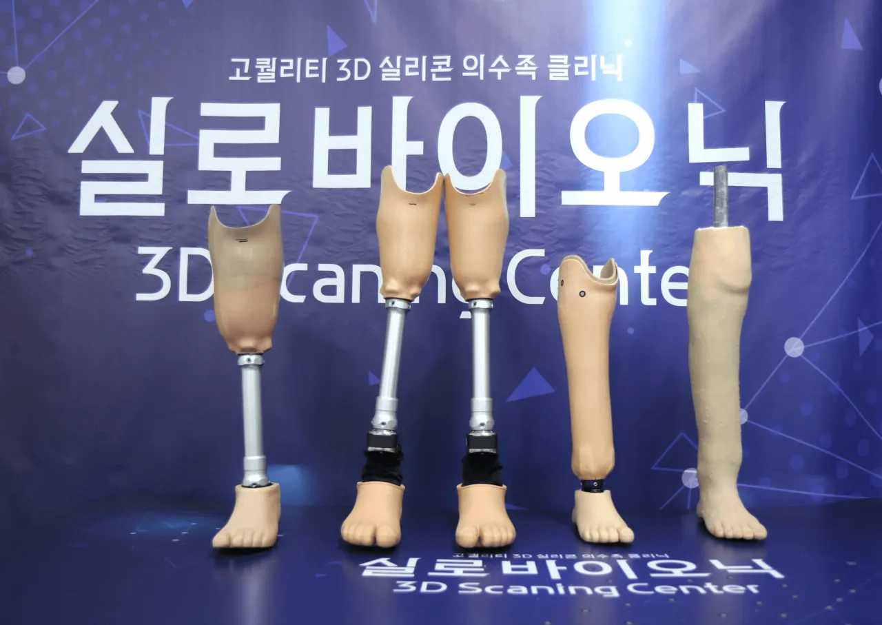 생방송투데이 의수 의족 전문가